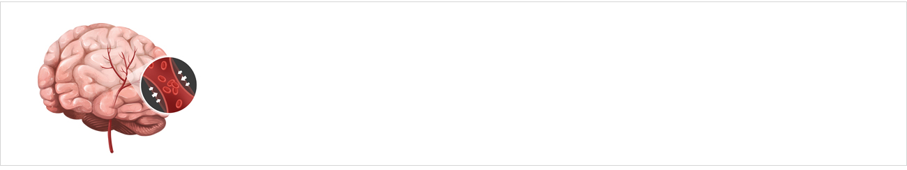 뇌신경질환 안내 이미지 1