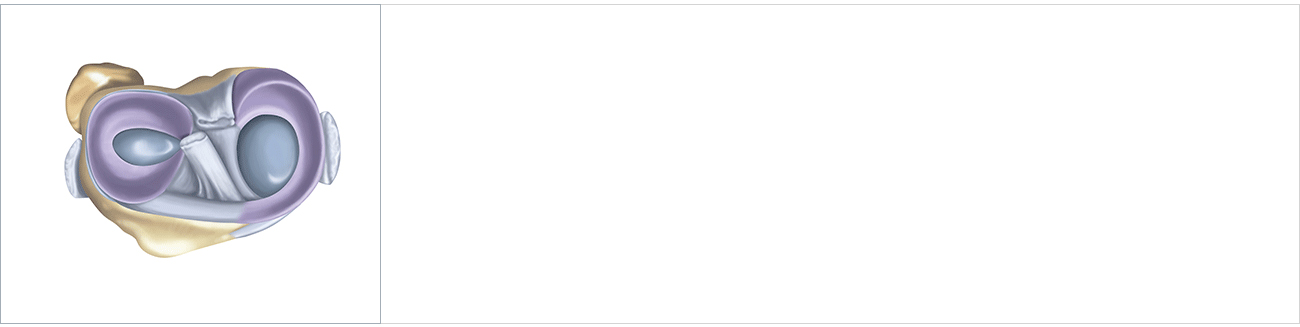 관절질환 안내 이미지 1