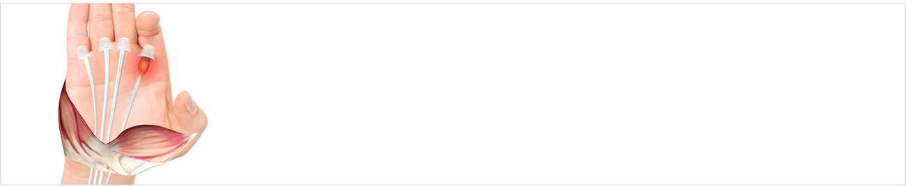 손발질환 안내 이미지 1