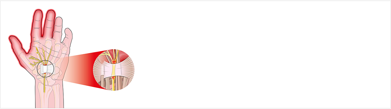손발질환 안내 이미지 1
