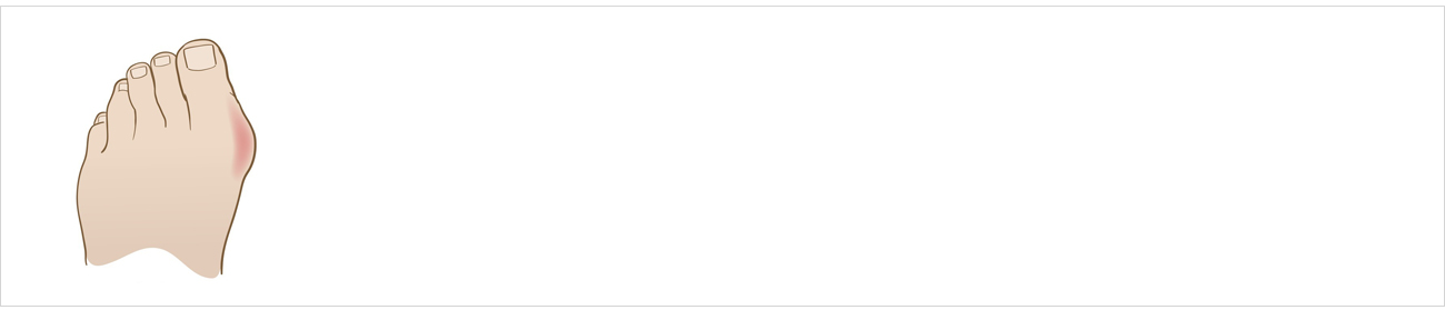 손발질환 안내 이미지 1