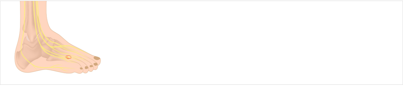 손발질환 안내 이미지 1
