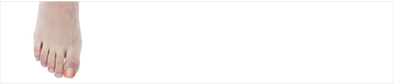 손발질환 안내 이미지 1