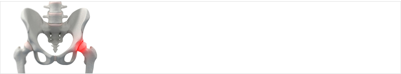 고관절질환 안내 이미지 1