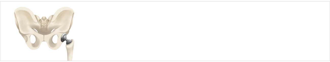 고관절질환 안내 이미지 1