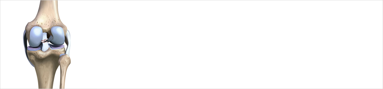 관절질환 안내 이미지 5