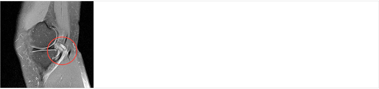 관절질환 안내 이미지 1