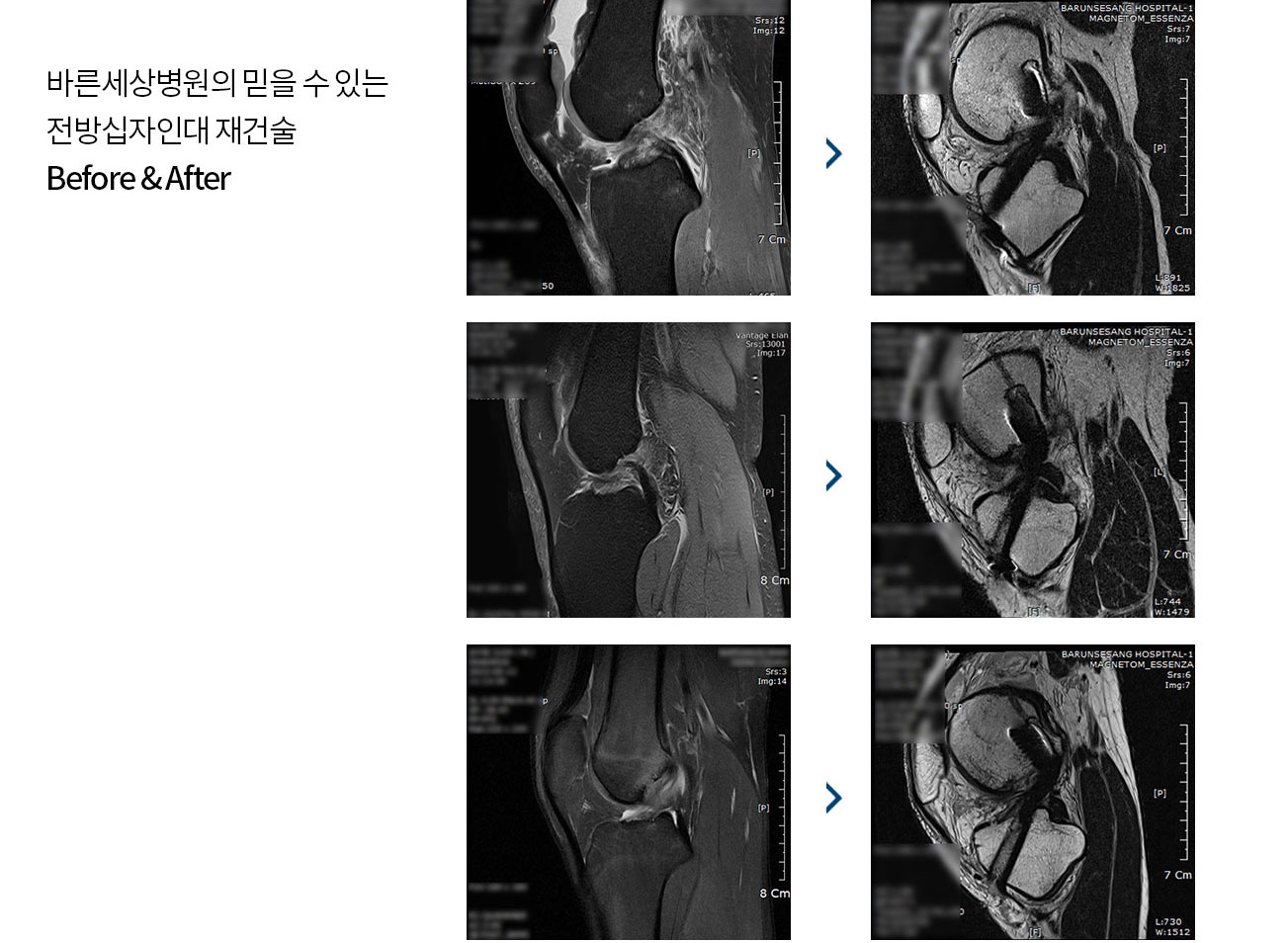 수술치료 안내 이미지 3