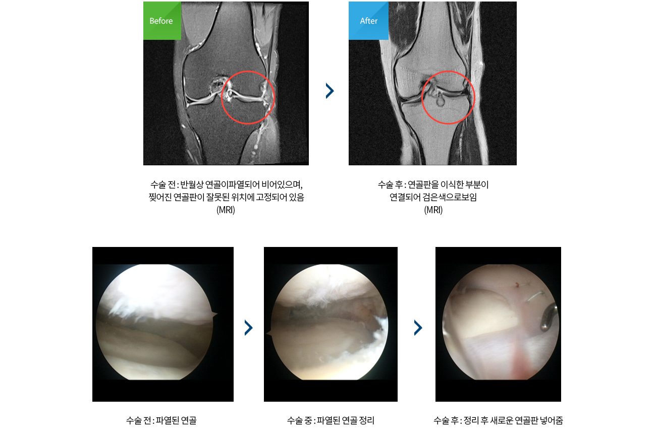 수술치료 안내 이미지 3