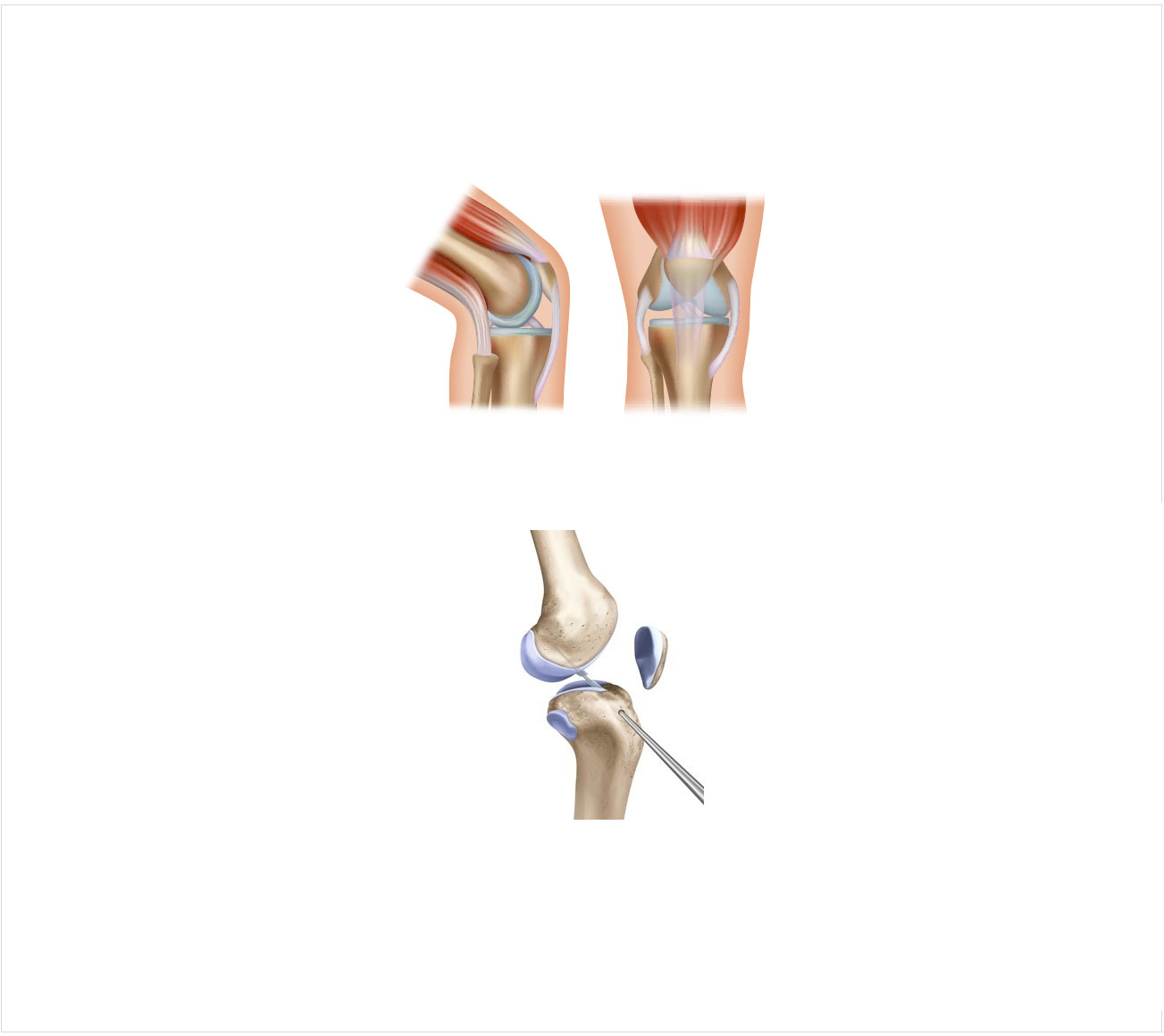 수술치료 안내 이미지 4