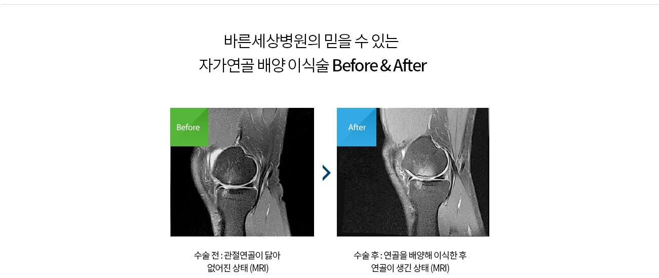 수술치료 안내 이미지 1