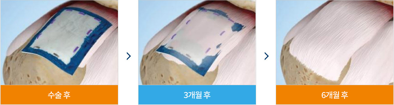 수술치료 안내 이미지 2
