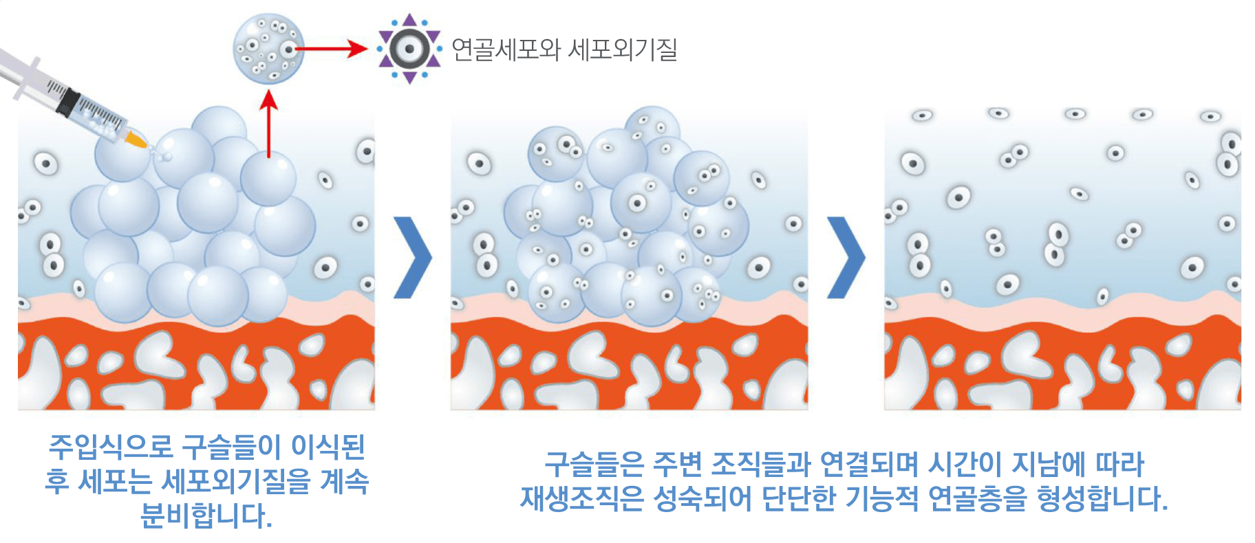 수술치료 안내 이미지 1