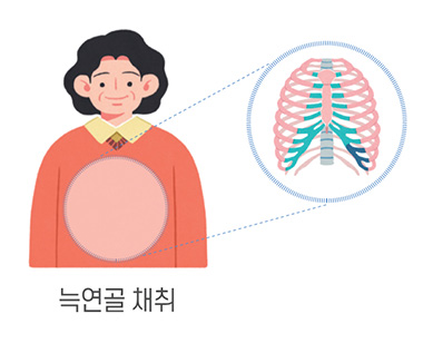 수술치료 안내 이미지 2